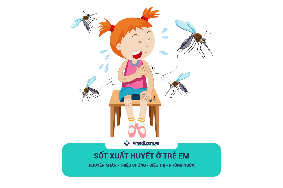 sot-xuat-huyet-o-tre-em