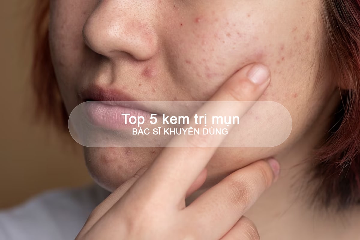 top-kem-tri-mun