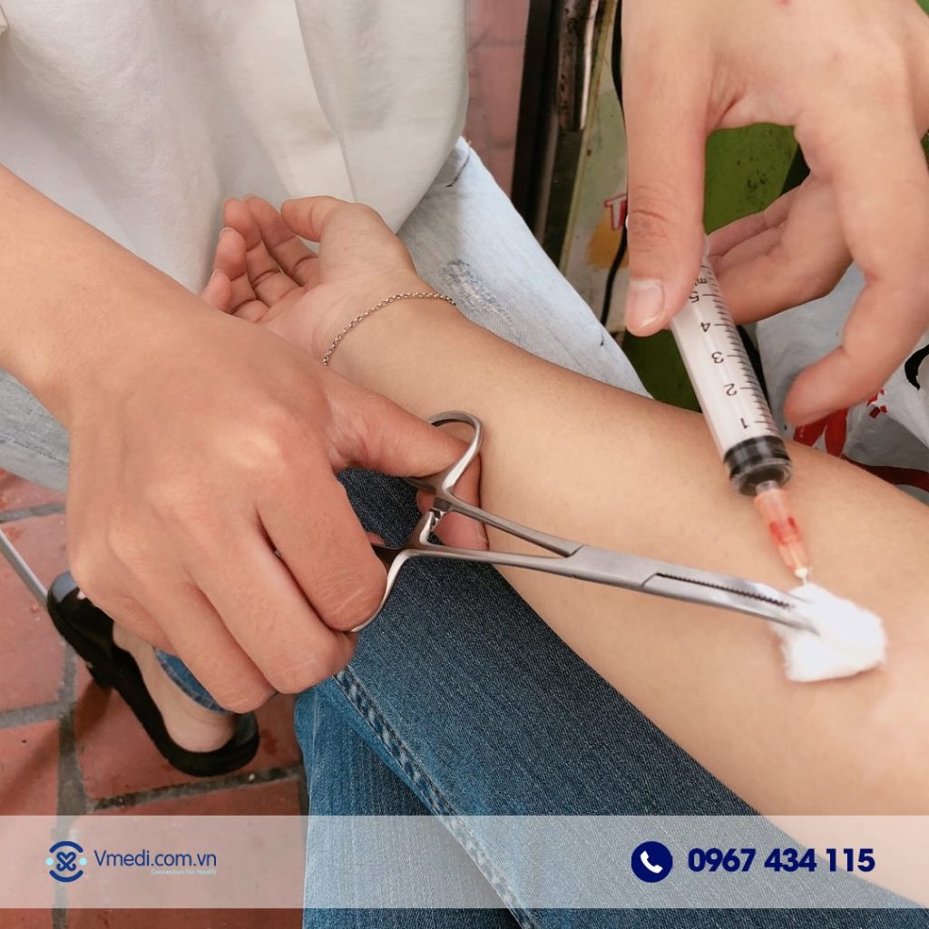 dich-vu-tiem-truyen-tai-nha