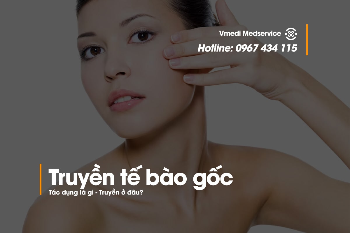 truyen-te-bao-goc